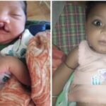 उम्मीद की मुस्कान : जब चिरायु टीम ने बदली एक नन्हे जीवन की कहानी