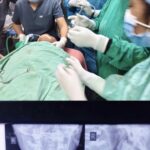 सिम्स बिलासपुर में डॉक्टरों का कमाल,6 वर्षीय मासूम की आहार नली से सफलतापूर्वक निकाला गया सिक्का, बची जान